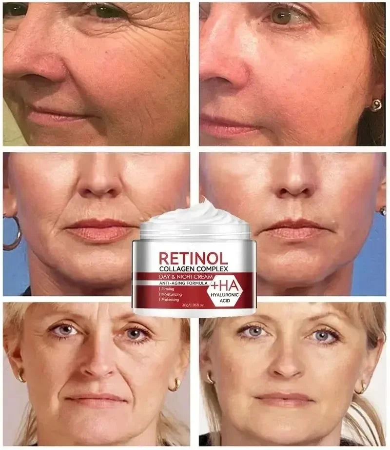 Creme Multi Complex Anti Rugas com Retinol
