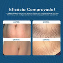 Creme Regenerador Dérmico Hidratante Anti-Stretch Marks 150g-Cicatribem-Para Estrias