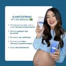 Creme Regenerador Dérmico Hidratante Anti-Stretch Marks 150g-Cicatribem-Para Estrias